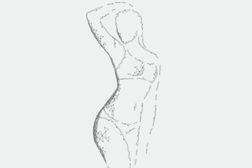 LipoLas_Übersicht_Anwendungen